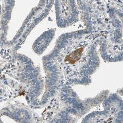 CIN85/SH3KBP1 Antibody, Novus Biologicals:Antibodies:Primary Antibodies